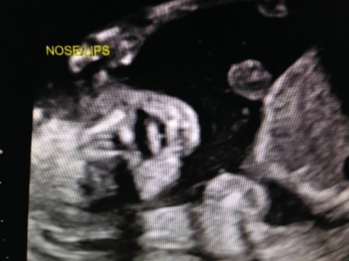 Face - Showing his tongue