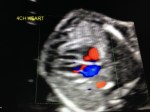 19w4d Ultrasound –&nbsp;Heart