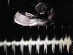 19w4d Ultrasound – Heart&nbsp;Rate