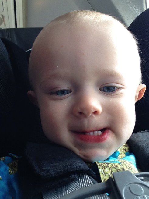 Demonstrating the underbite - May 27, 2016